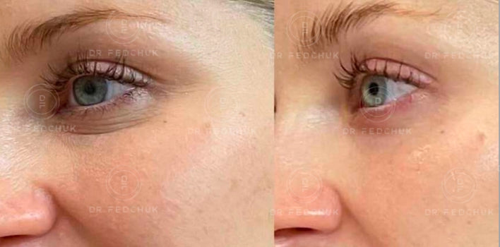 JUVENA + CELL RENEW Peeling System