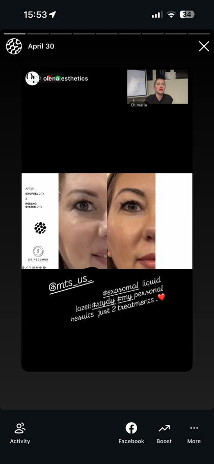 Transformation image