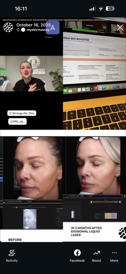 Transformation image
